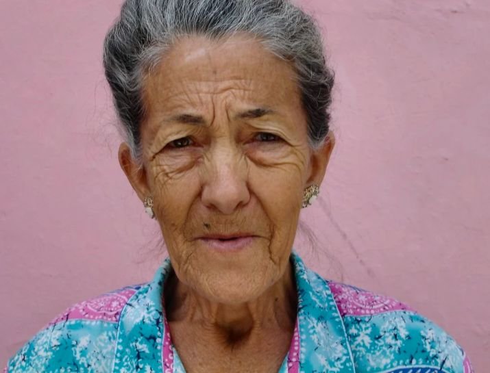 cómo se contrae el Lupus